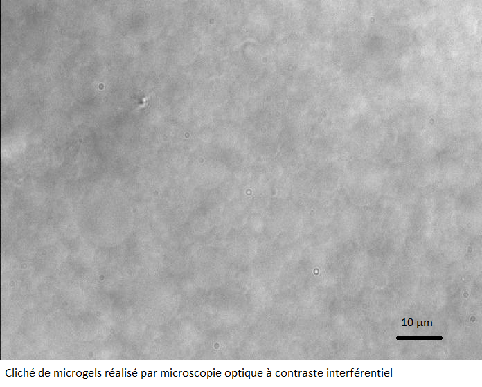 Microscopie électronique et cryofracture - Transform